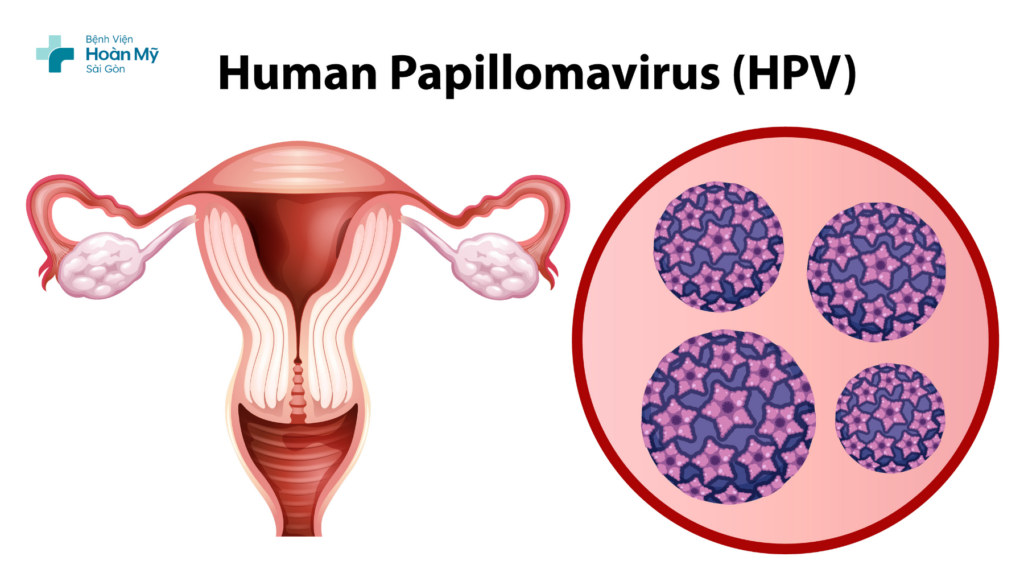 Hướng dẫn tầm soát ung thư cổ tử cung